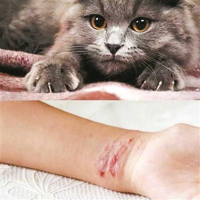 猫抓病可非小事小心为健康埋下隐患