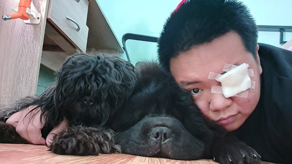菲律宾黑色松狮犬竟撞飞主人眼角膜,但事后关系却更亲近 菲律宾黑色松狮犬竟撞飞主人眼角膜,但事后关系却更亲近