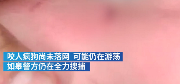 连续咬伤21人恶犬已抓获，最小伤者3岁
