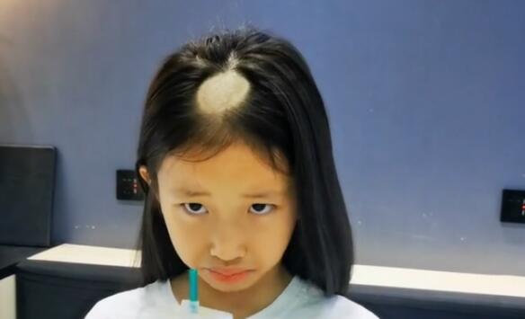 养了一只猫，10天后，猫咪让小主人变成了“秃头少女”