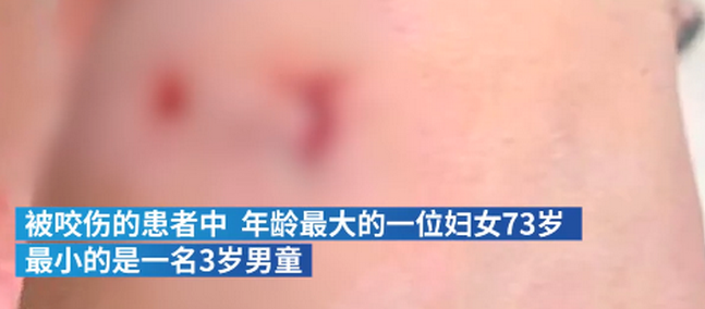 连续咬伤21人恶犬已抓获，最小伤者3岁