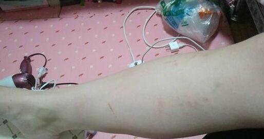 女孩领养了一只小奶猫，喂养不到半个月，哭诉全身上下都是伤痕