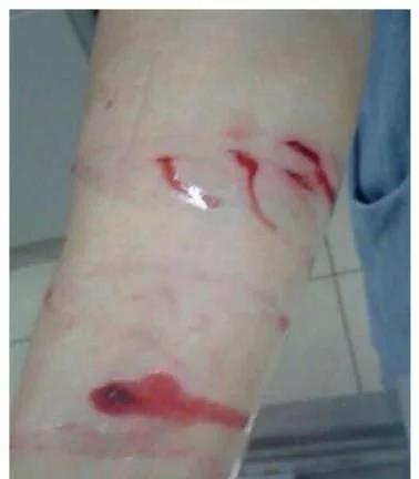 金毛为出门咬伤主人,主人从医院回来后,见到让她崩溃一幕 金毛为出门咬伤主人,主人从医院回来后,见到让她崩溃一幕