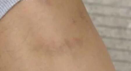 这条恶犬咬狗又咬人为什么主人就是不牵绳 这条恶犬咬狗又咬人为什么主人就是不牵绳