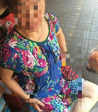 被别人宠物猫抓伤不负责 | 老太被水果店里的猫抓伤 店主不愿承担责任引发纠纷 被别人宠物猫抓伤不负责 | 老太被水果店里的猫抓伤 店主不愿承担责任引发纠纷