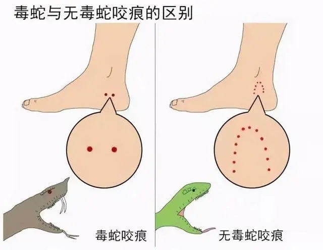 如果遇到蛇,我们应该如何自保?快学习一下吧! 如果遇到蛇,我们应该如何自保?快学习一下吧!