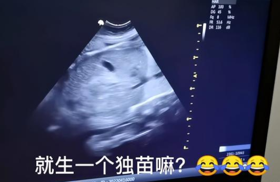 宠物博主刘布宝翻车，恼羞成怒怼网友脏话频出，本人还是老师？