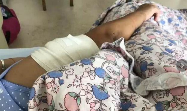 女子被养了5年的狗咬得血肉恍惚已经不是第一次 女子被养了5年的狗咬得血肉恍惚已经不是第一次
