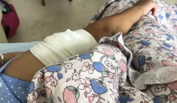 女子被养了5年的狗咬得血肉恍惚已经不是第一次 女子被养了5年的狗咬得血肉恍惚已经不是第一次