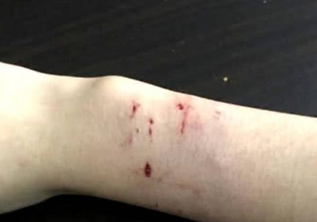 男子失恋回到家，抱着猫咪擦泪又擦鼻涕，猫咪反击后成功进医院