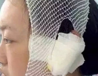 狗主因自家小狗被路人骂而狠心咬掉对方耳朵 狗主因自家小狗被路人骂而狠心咬掉对方耳朵