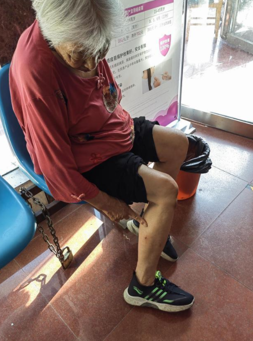 当心!炎夏来临 宠物伤人进入高发期 门诊一天竟高达200人 当心!炎夏来临 宠物伤人进入高发期 门诊一天竟高达200人