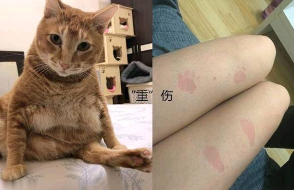 女子抱了10分钟橘猫 双腿就受了“重伤” 拍下照片让人羡慕 女子抱了10分钟橘猫 双腿就受了“重伤” 拍下照片让人羡慕