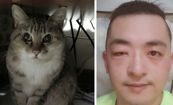 对猫毛严重过敏 依旧守护爱猫21个年头