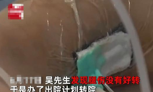 小猫偷吃东西，男子打它一下反被咬，小腿感染肿得像气球