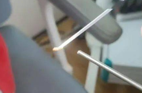 吓一跳！9岁儿童耳朵里取出活蛆，医生紧急提醒