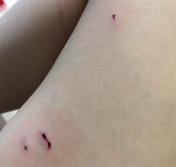 因主人收养流浪猫，橘猫发狂抓伤主人，主人一气之下怒打猫咪