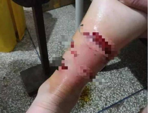 8条狗被“鸭骨头”毒死,网友:那个人,一定是忍无可忍了 8条狗被“鸭骨头”毒死,网友:那个人,一定是忍无可忍了