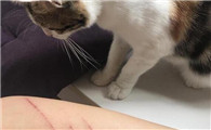 为什么大部分人被猫抓伤不打针