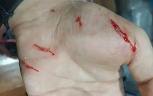 猫咪打了狂犬疫苗被咬了会有事吗