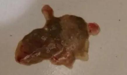 狗狗拉稀果冻状粘稠带血怎么办
