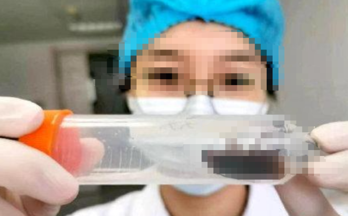 我国首次截获全球新物种蜚蠊 我国首次截获全球新物种蜚蠊
