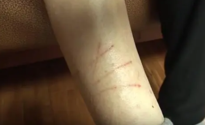 斯芬克斯猫攻击主人,原因居然让所有人心疼 斯芬克斯猫攻击主人,原因居然让所有人心疼