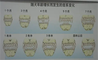 幼犬各阶段牙齿图
