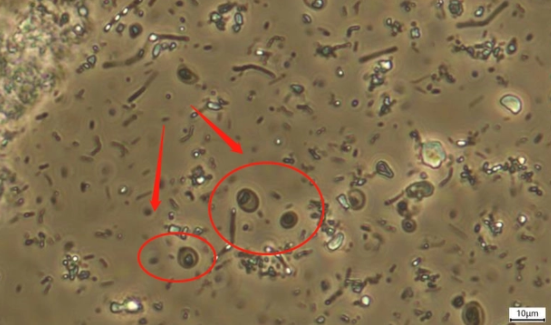 宠物常见寄生虫危害科普!看完我决定不给宠物驱虫了 宠物常见寄生虫危害科普!看完我决定不给宠物驱虫了