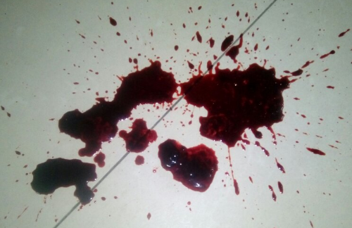 狗狗不吃东西还拉血怎么回事?我来告诉你 狗狗不吃东西还拉血怎么回事?我来告诉你