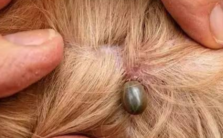 被蜱虫咬了初期是什么症状？后果很严重吗？