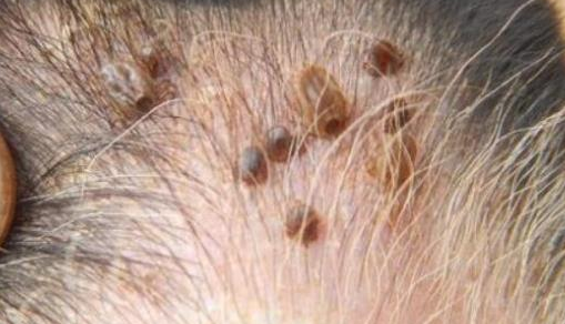 狗狗身上有蜱虫体外驱虫能去掉吗