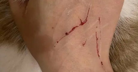 猫挖住手没有出血需要打针吗?铲屎官来瞧瞧吧 猫挖住手没有出血需要打针吗?铲屎官来瞧瞧吧