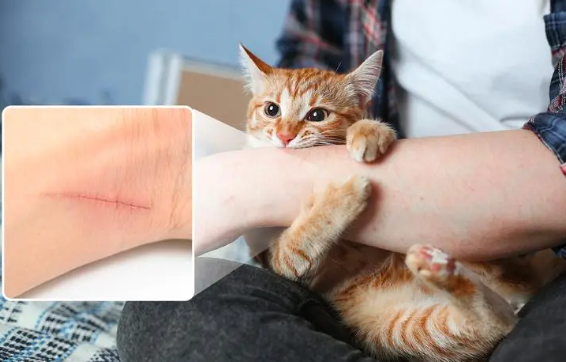 为什么会被猫咪抓破皮呢