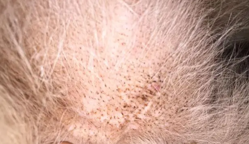 狗狗身上为什么总痒