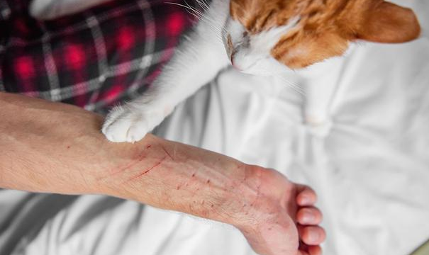 被猫抓10天后还能打疫苗吗