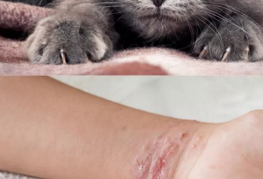 有多少人死于猫抓伤 有多少人死于猫抓伤