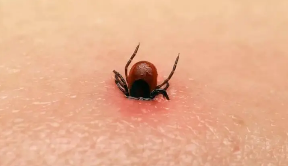 脚上长满了蜱虫图片