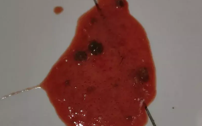 猫呕吐红色液体和泡沫,要重视! 猫呕吐红色液体和泡沫,要重视!