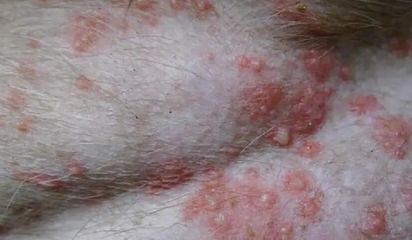 狗狗真菌性皮肤病如何治疗？