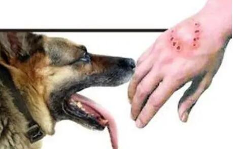 狂犬病的病因与诊断要点