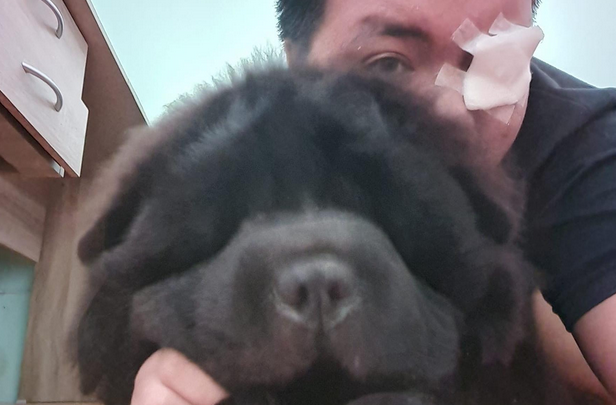 狗狗误伤男子眼睛后，表现得很黏人，这是怕主人离去