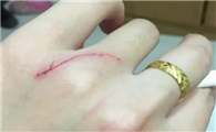 为什么猫咪抓了要打针呢