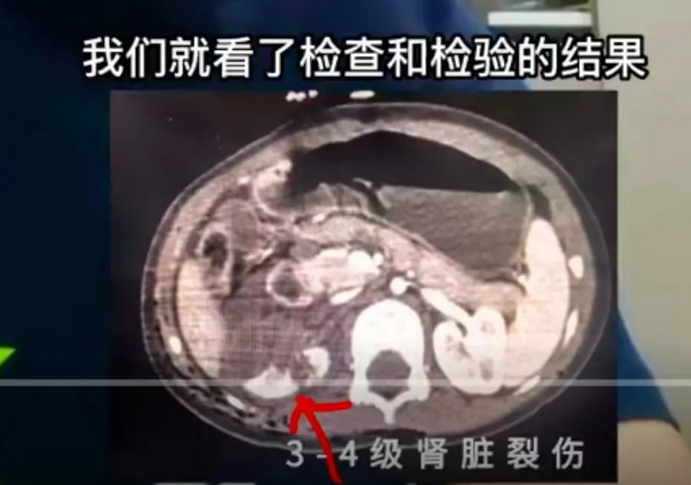 罗威纳犬攻击性那么强,成都为什么不禁养? 罗威纳犬攻击性那么强,成都为什么不禁养?