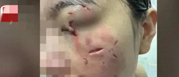 一向乖巧的宠物狗,被一女子逗发性情,后果不堪 一向乖巧的宠物狗,被一女子逗发性情,后果不堪