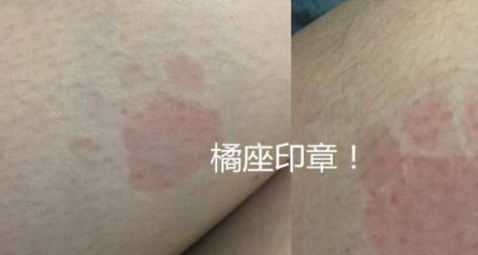 女子抱了10分钟橘猫,双腿就受了“重伤”,拍下照片却引众人羡慕 女子抱了10分钟橘猫,双腿就受了“重伤”,拍下照片却引众人羡慕