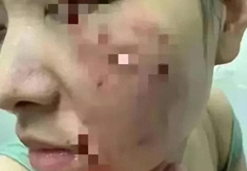 江苏松狮犬咬人最新后续，女子索赔800万遭拒，狗主人怒杀爱犬