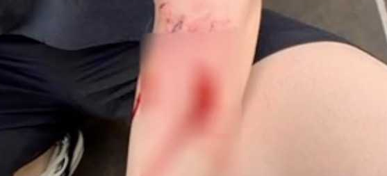 触目惊心!杜宾犬突然发狂连咬3人,主人也不放过 触目惊心!杜宾犬突然发狂连咬3人,主人也不放过