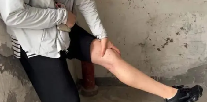 重庆一小区流浪猫死亡致跳蚤成灾，消杀无果，有孩子被咬满腿疙瘩！