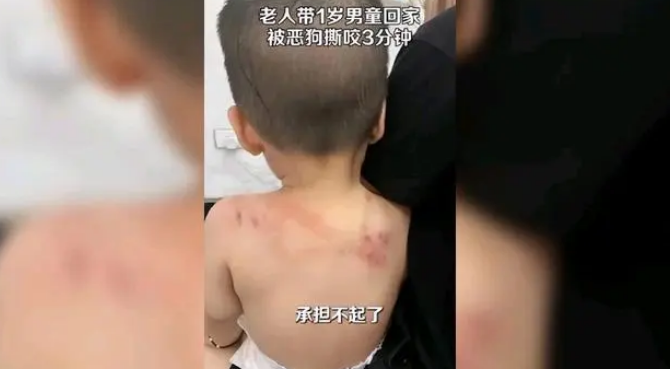 奶奶抱着一岁男童被狗撕咬3分钟 奶奶抱着一岁男童被狗撕咬3分钟